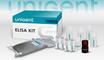 «Юниджент» — новая эра в поставках импортных реактивов: 1С:УНФ с китайским интерфейсом для международной автоматизации