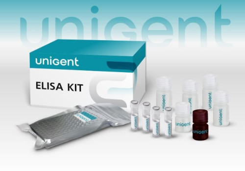 «Юниджент» — новая эра в поставках импортных реактивов: 1С:УНФ с китайским интерфейсом для международной автоматизации